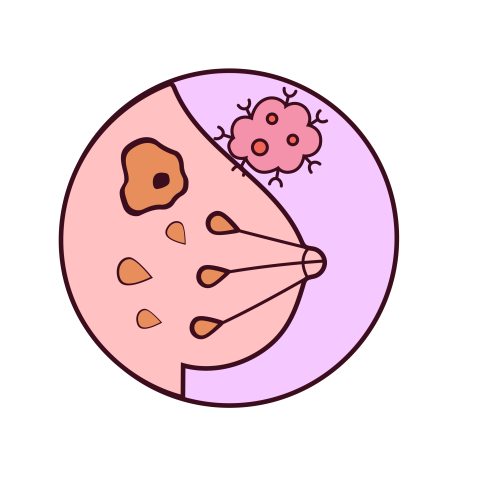 Breast Cancer Illustration Vectors free download